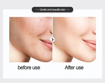 Two 500ml bottles of Senana essence toner, Hyaluronic Acid and Niacinamide formulas, tied together with a red bow